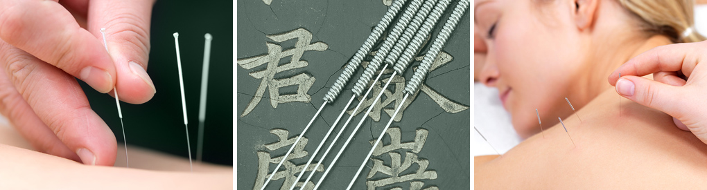 Surrey Acupuncture